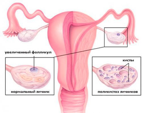 ���������� ��������