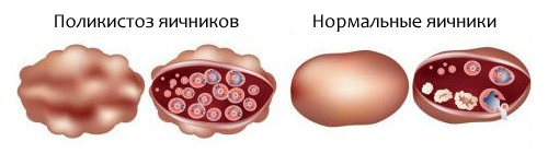 ���������� � ���������� �������