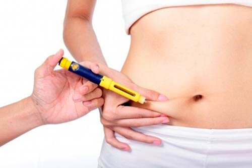 ���������� ��������