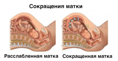 сокращения матки