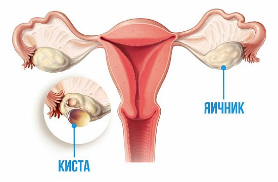 ����� ������� �����������